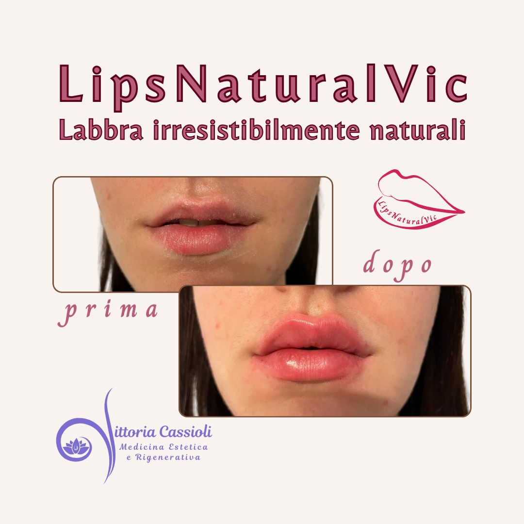 Vittoria Cassioli-43