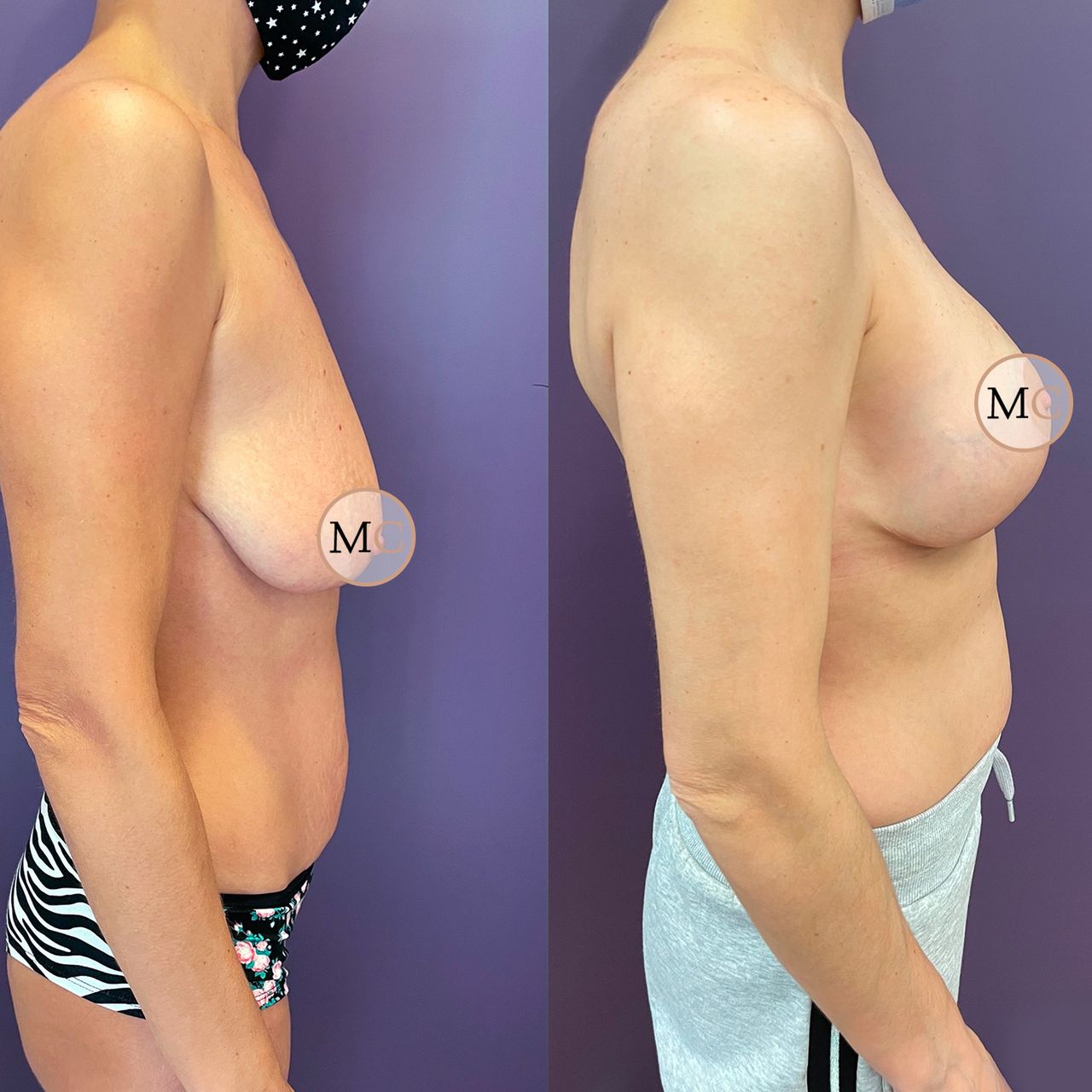 Marco Carmisciano-12