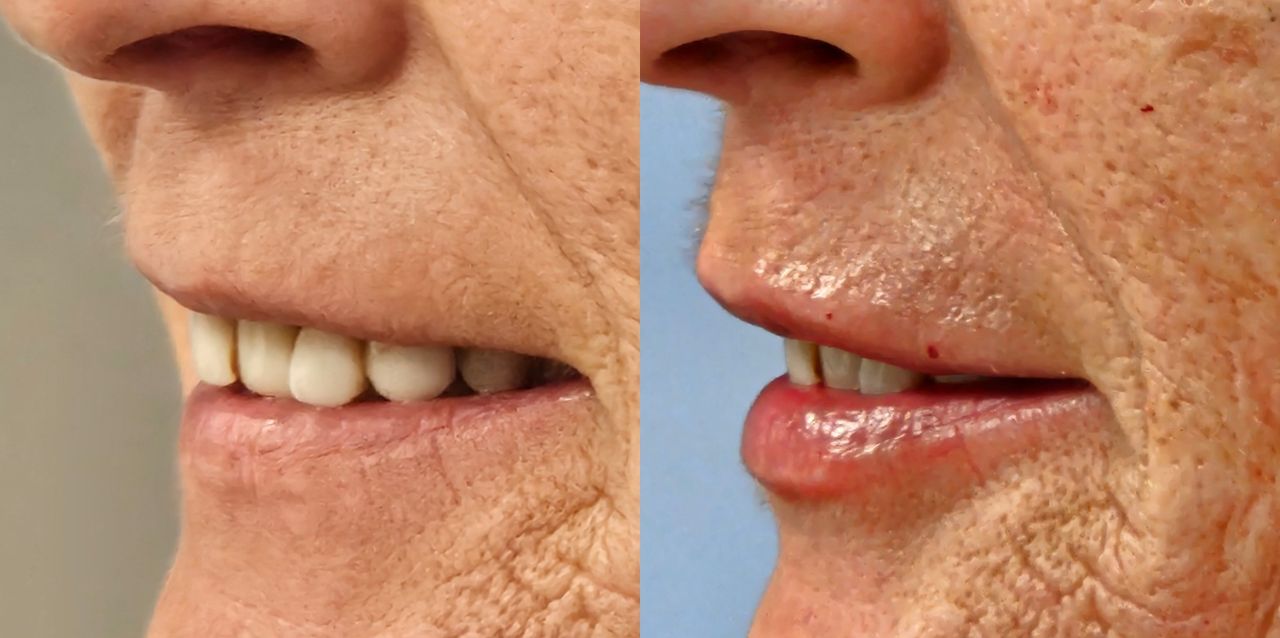 Rosalba Herrero Zerpa-569