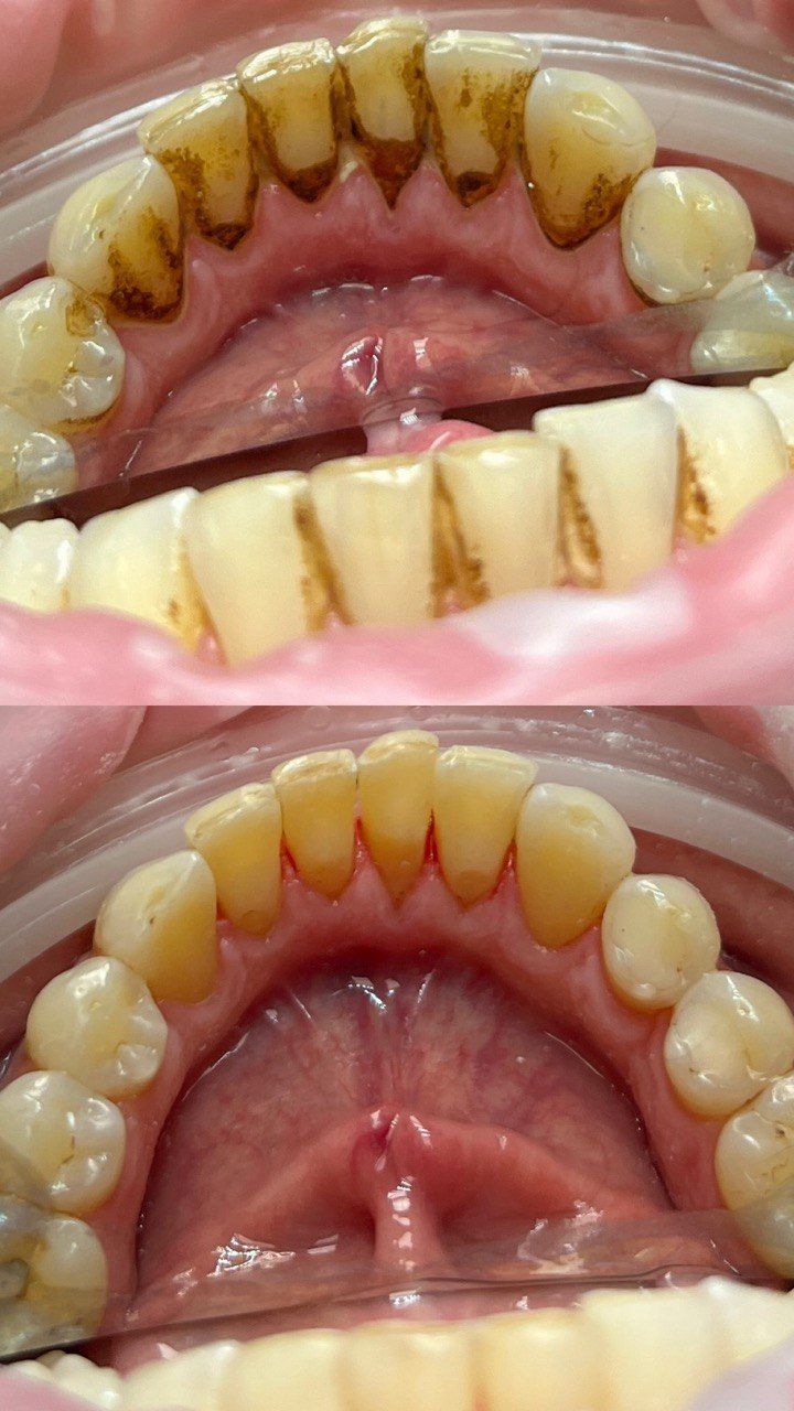 Tetiana Starodubets-10