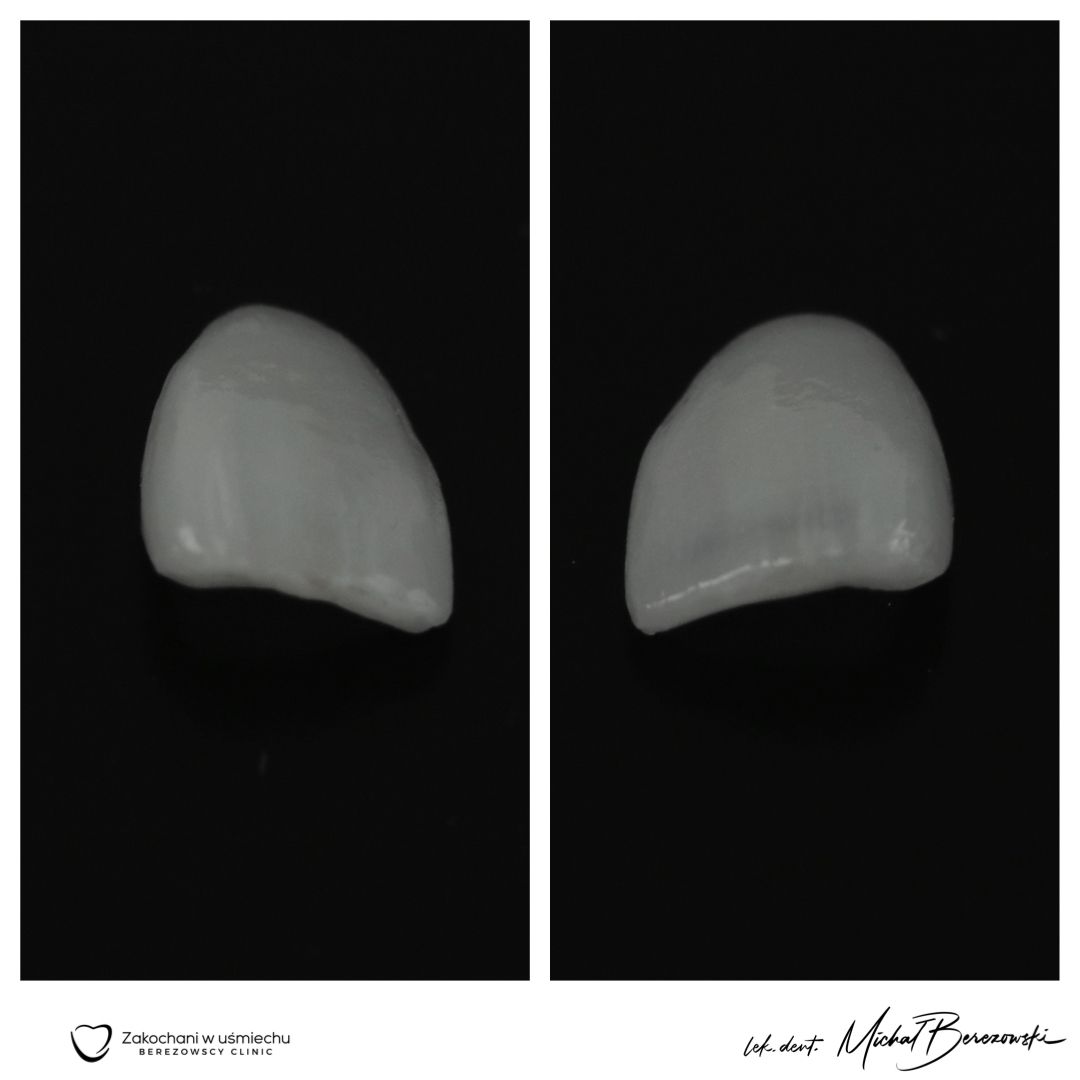 Michał Berezowski-24