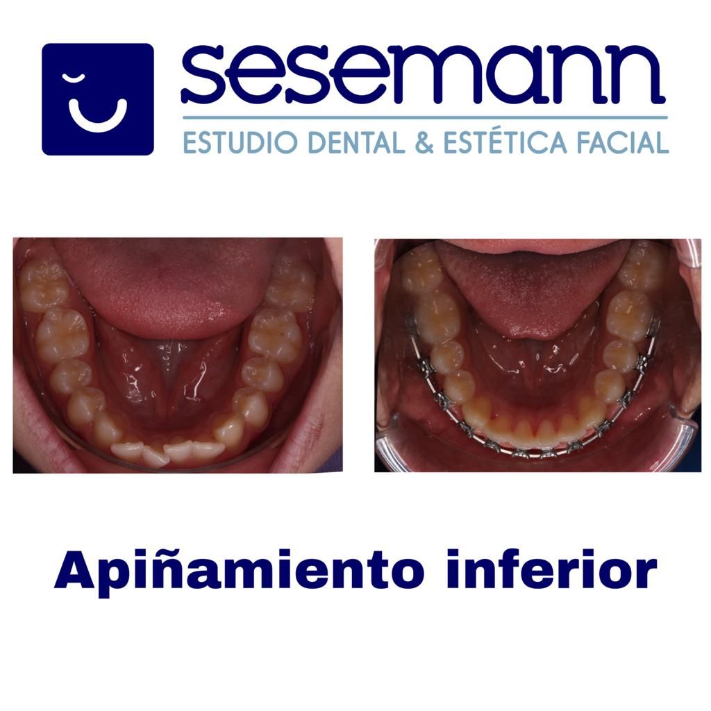 Paula Cano Carrillo-118