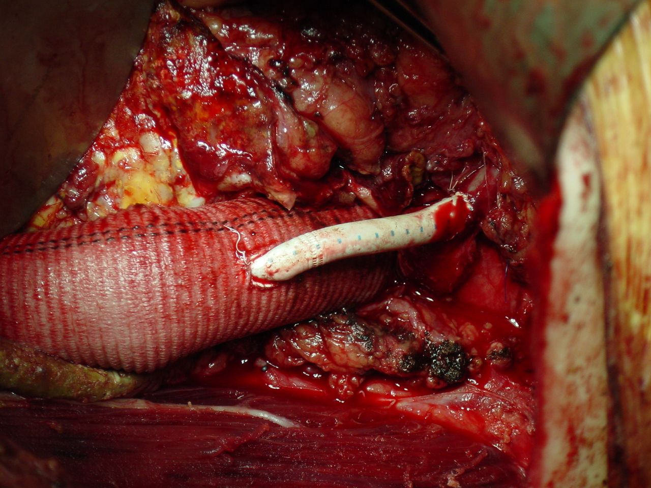 Secundino Llagostera Pujol-1