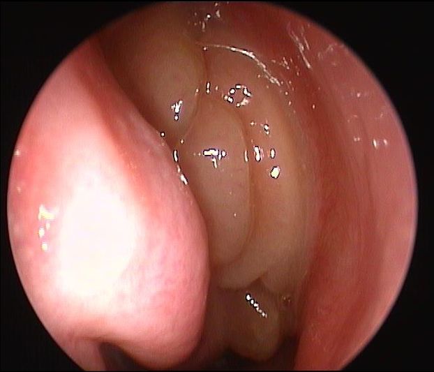 Francesco Zappoli Thyrion-8