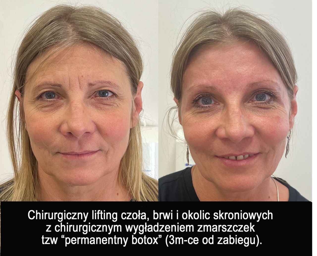 Mariusz Zagajewski-38