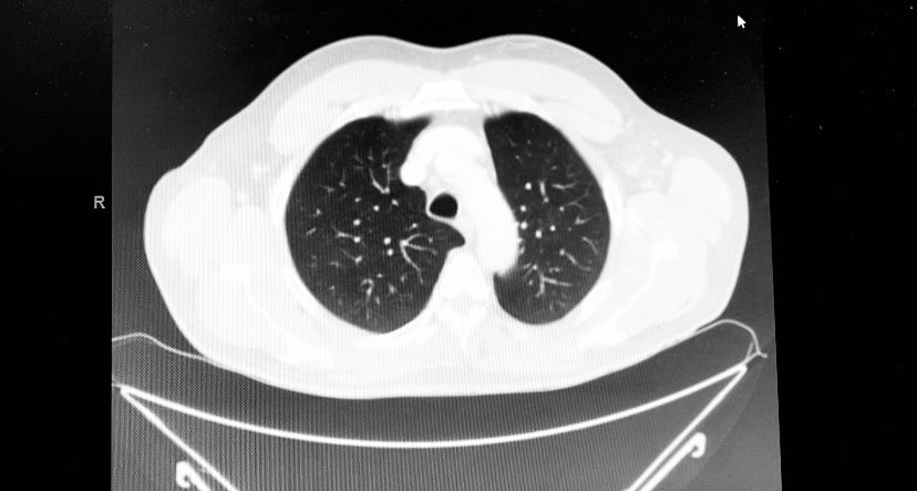 Ana Hernandez Voth-0