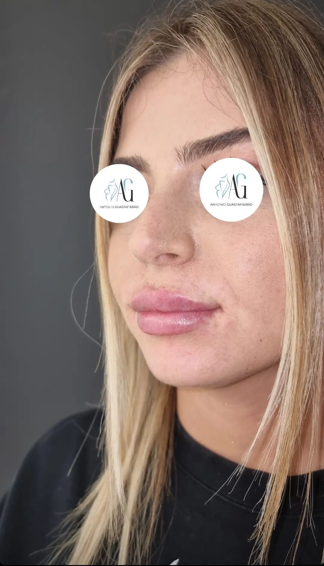 Antonio Guastafierro-8