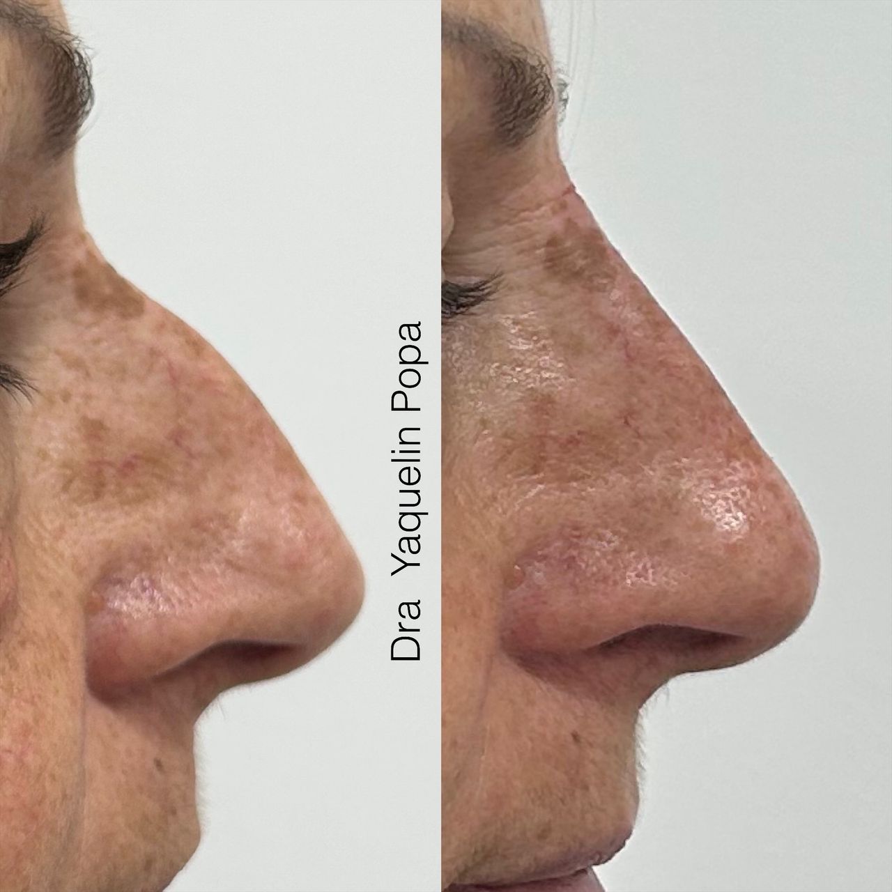 Yaquelin Popa Rosales-6