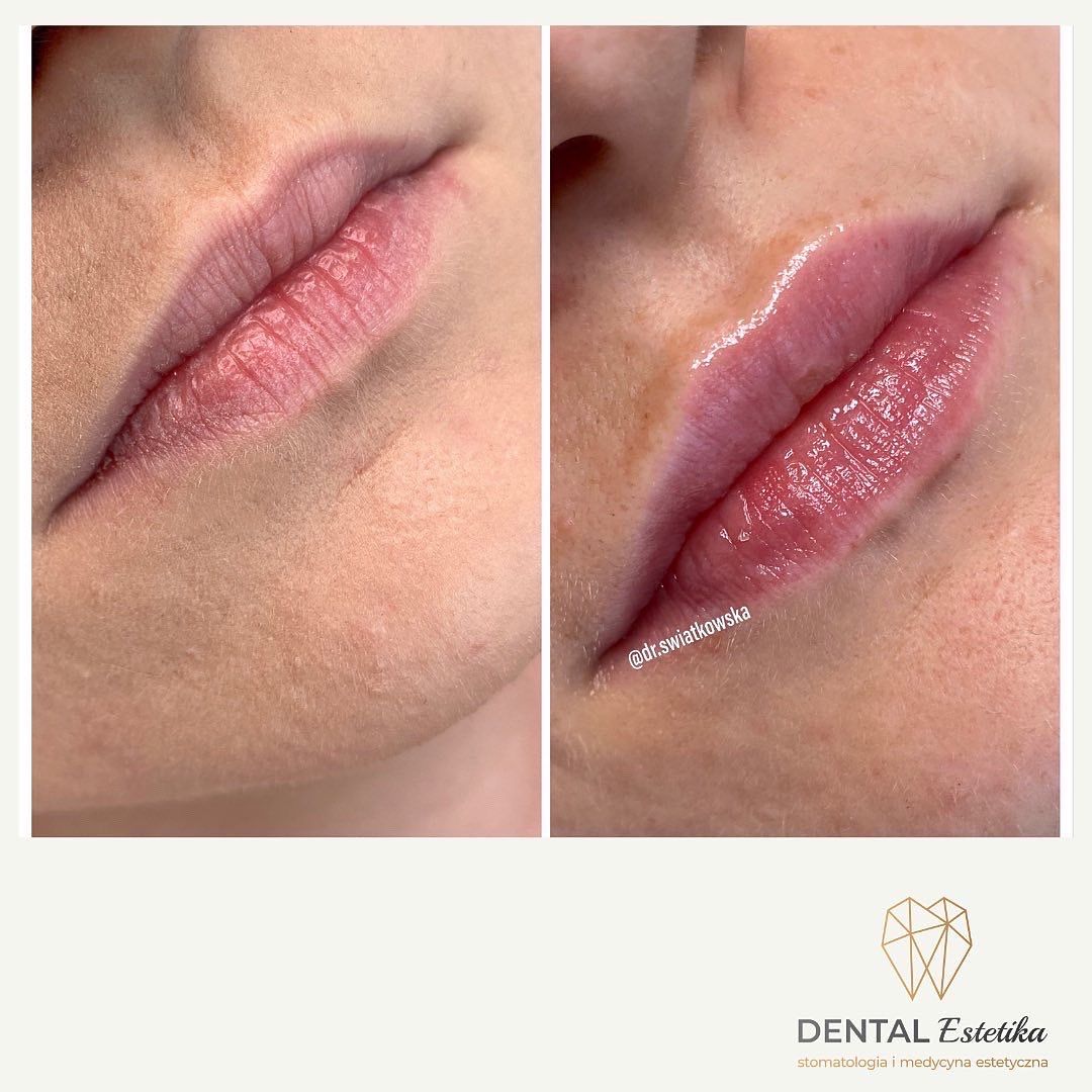 Angelika Świątkowska-24