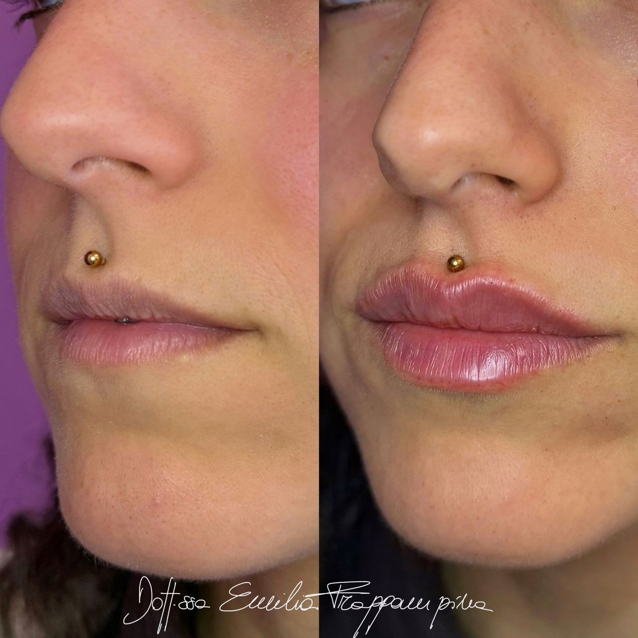 Emilia Frappampina-10