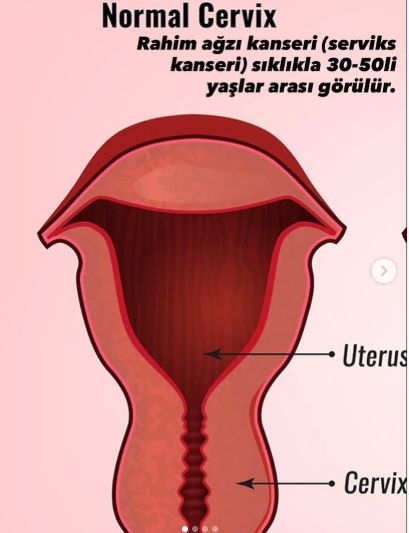 Melike Omak Yıldırım-2