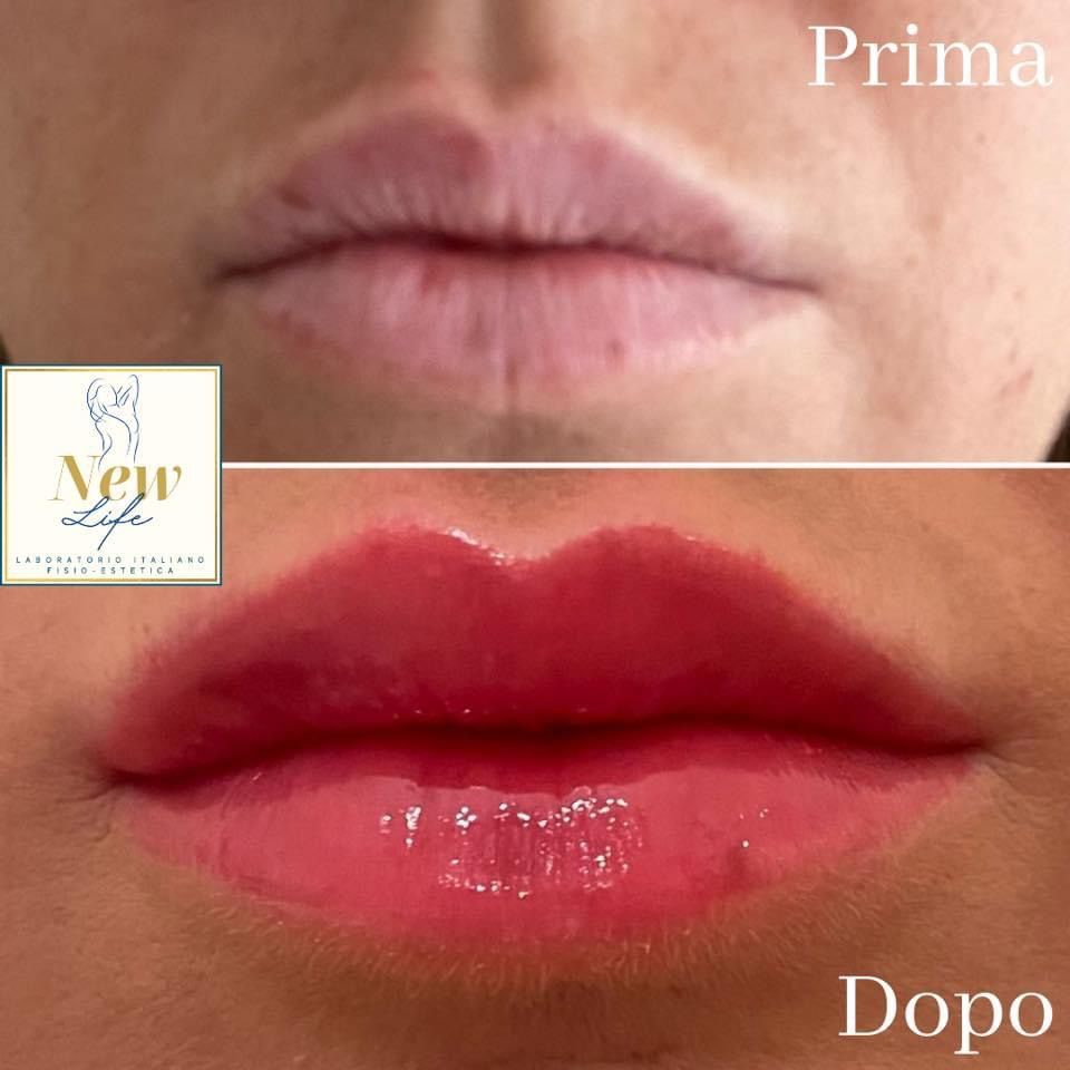 Gaetano Salvatore Canfarelli-4