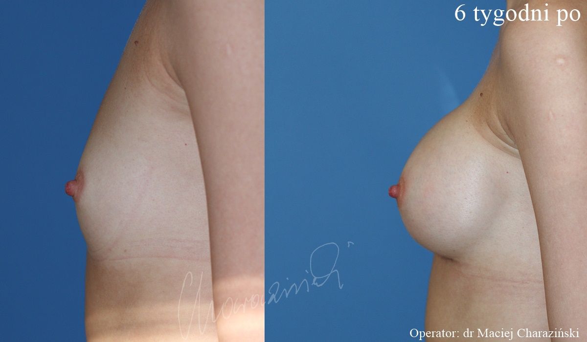 Maciej Charaziński-90