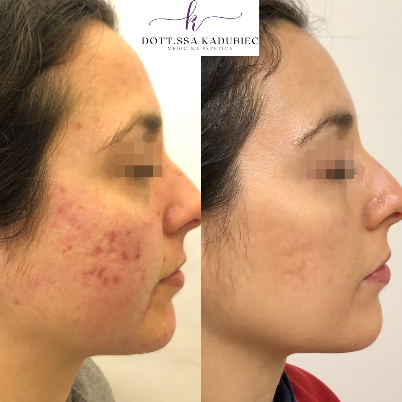 Aleksandra Kadubiec-19