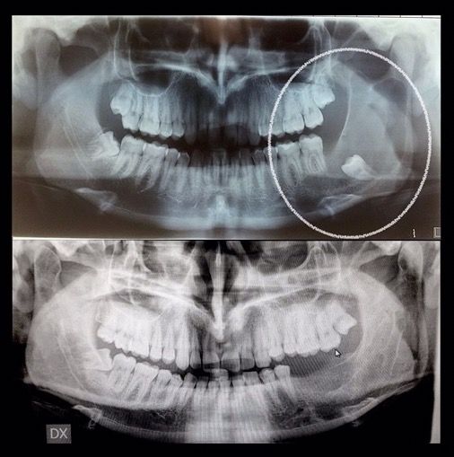 Alessandro Agrillo-2