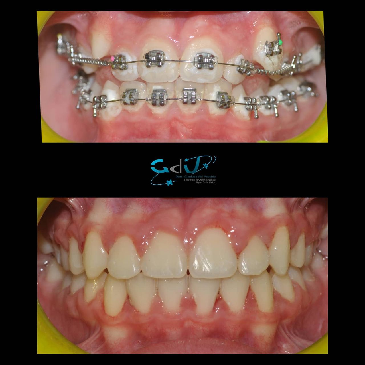 Gianluca Del Vecchio-113