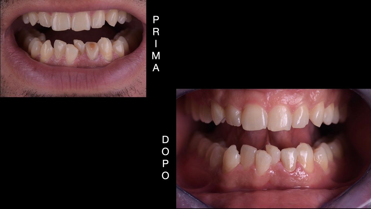 Riccardo Giardina-44