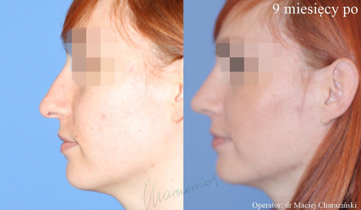 Maciej Charaziński-77