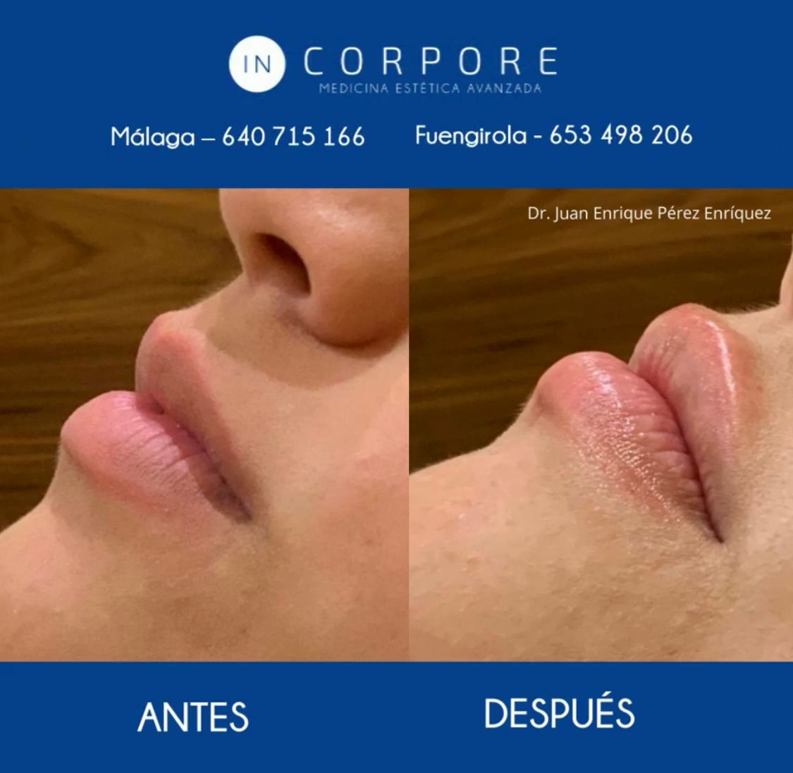 Juan Enrique Pérez Enríquez-44