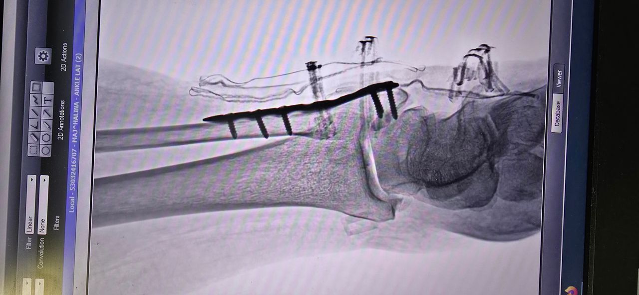 Łukasz Kapiczenko-3