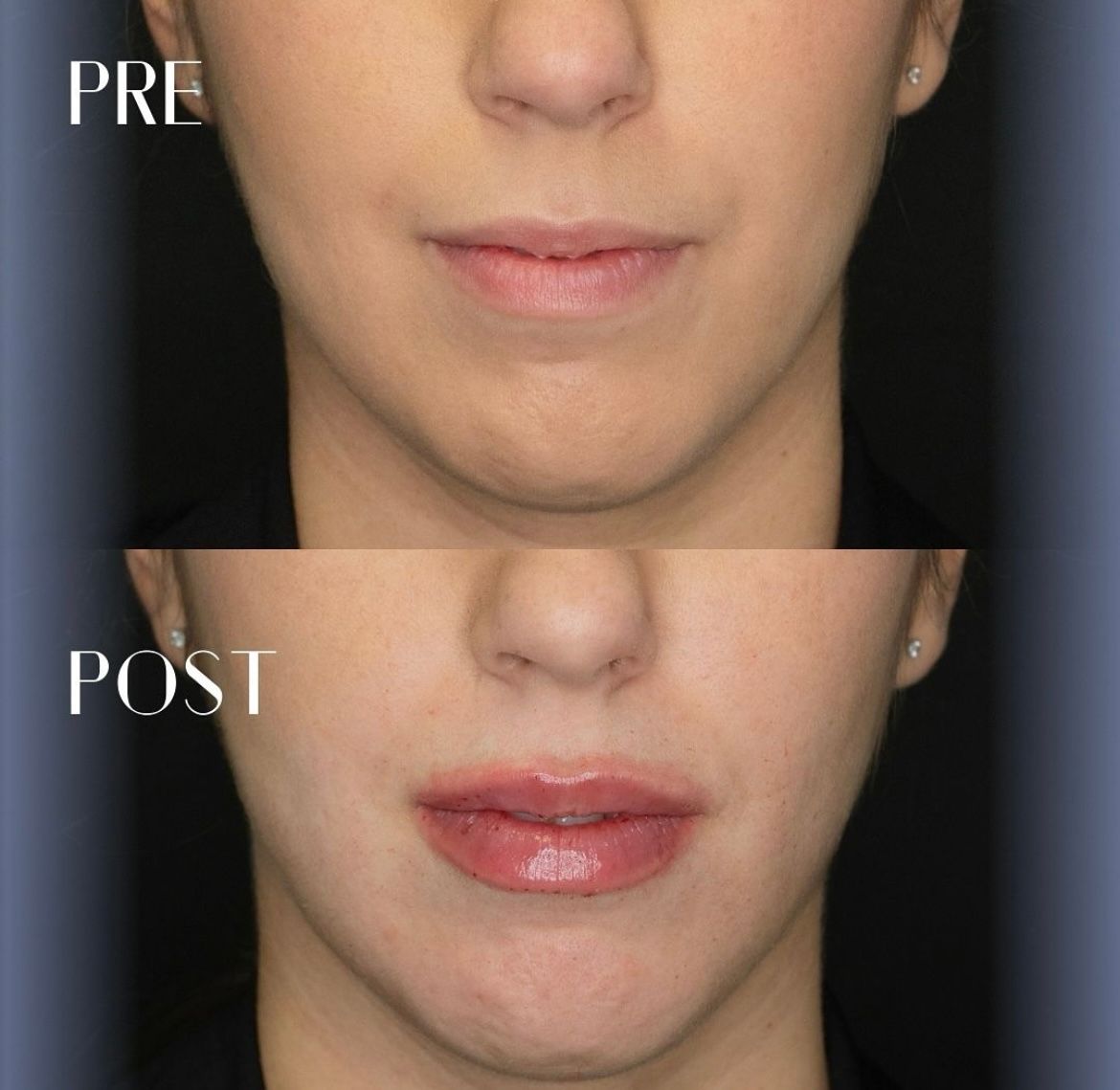 Marco Rizzetto Stubel-8