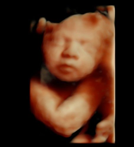 Tommaso Incandela-63