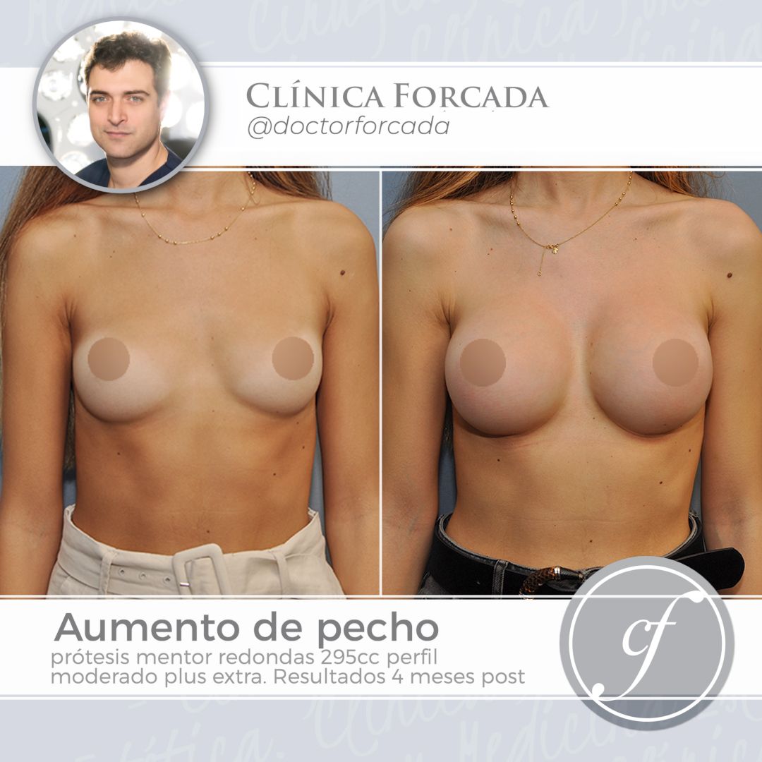 Eduardo Forcada Melero-7