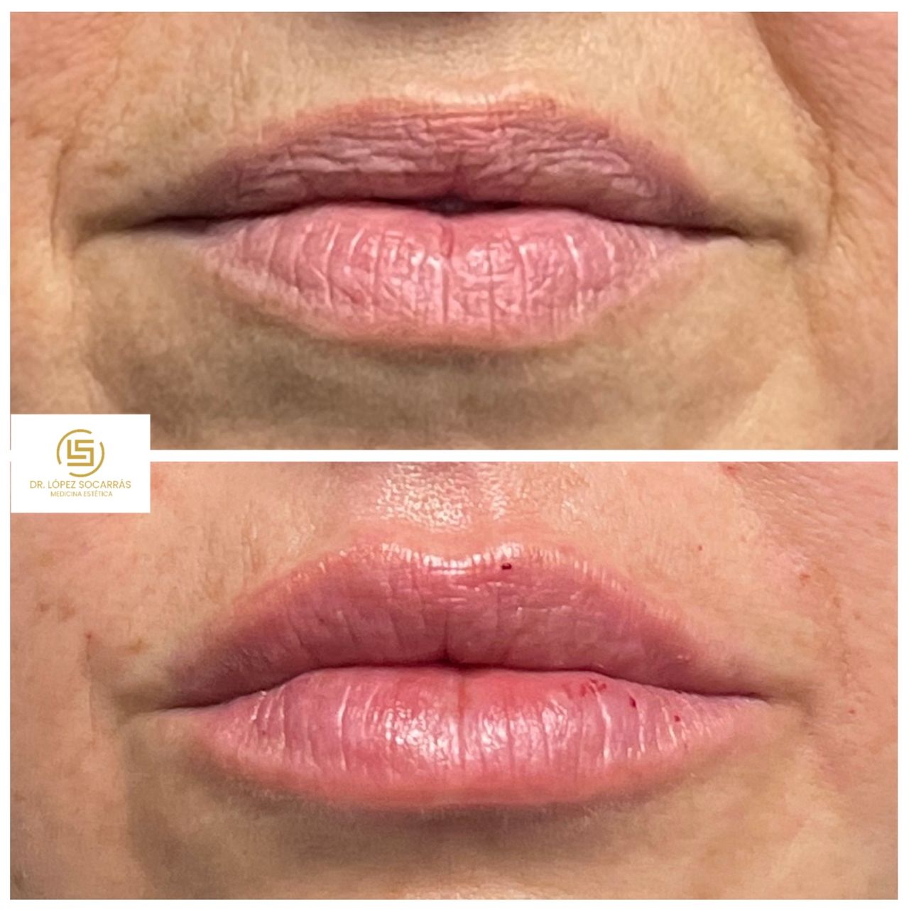 Camilo López Socarrás-14