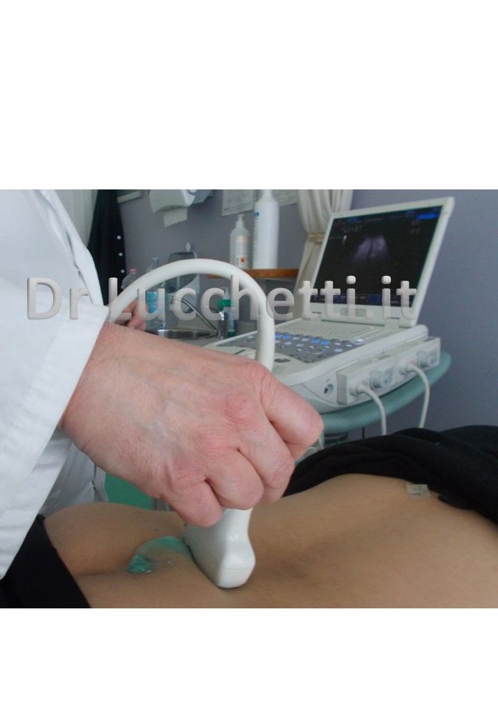 Francesco Lucchetti-0