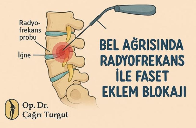 Çağrı Turgut-1