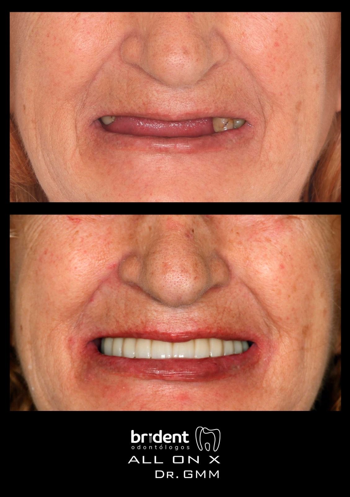 Guillermo Moreno Fragoso-65