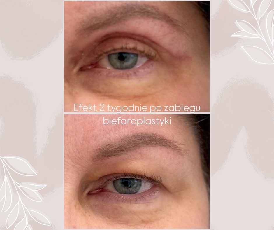 Piotr Florczuk-Dąbek-7