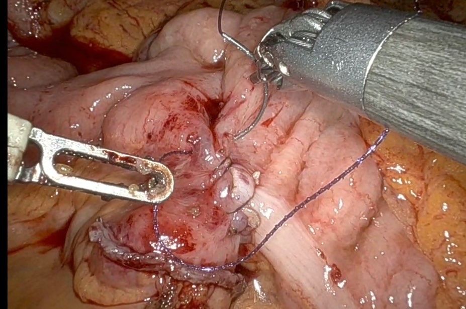 Marcello Gasparrini-3