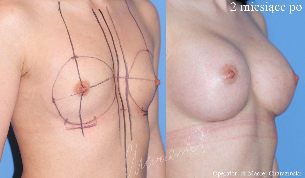 Maciej Charaziński-96