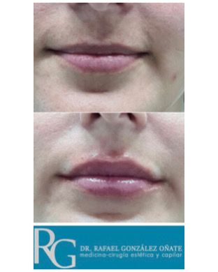 Rafael Gonzalez Oñate-19