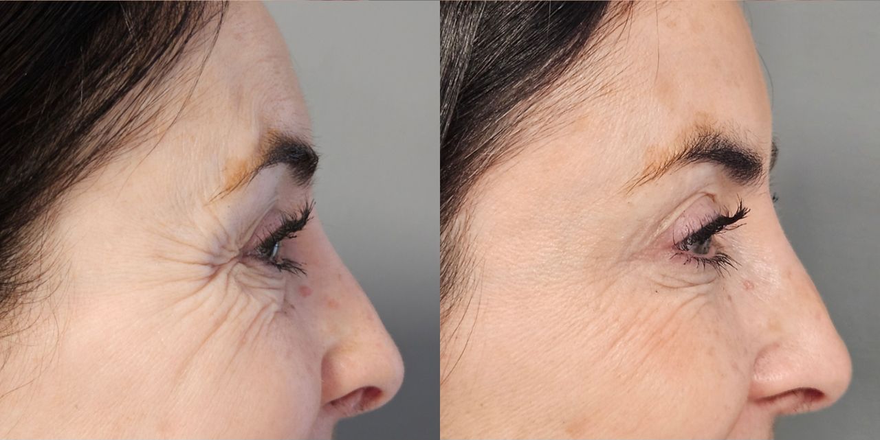 Rosalba Herrero Zerpa-23