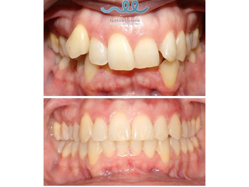 Esther Llorens Alonso-10