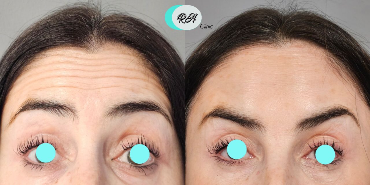 Rosalba Herrero Zerpa-605