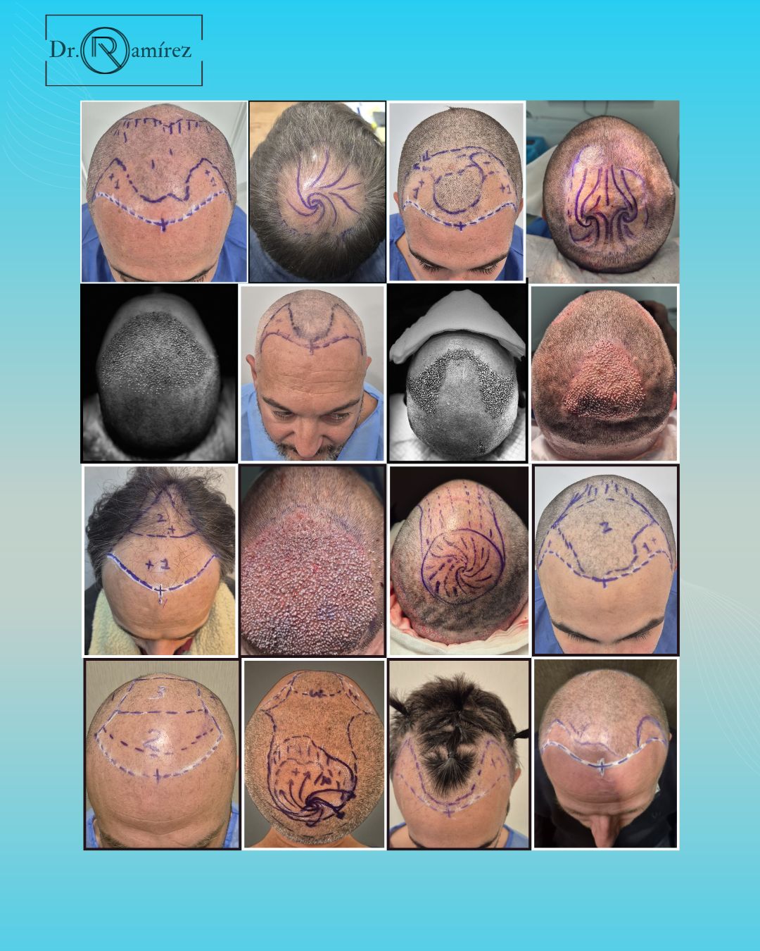 Ernesto Ramirez Fernández-2