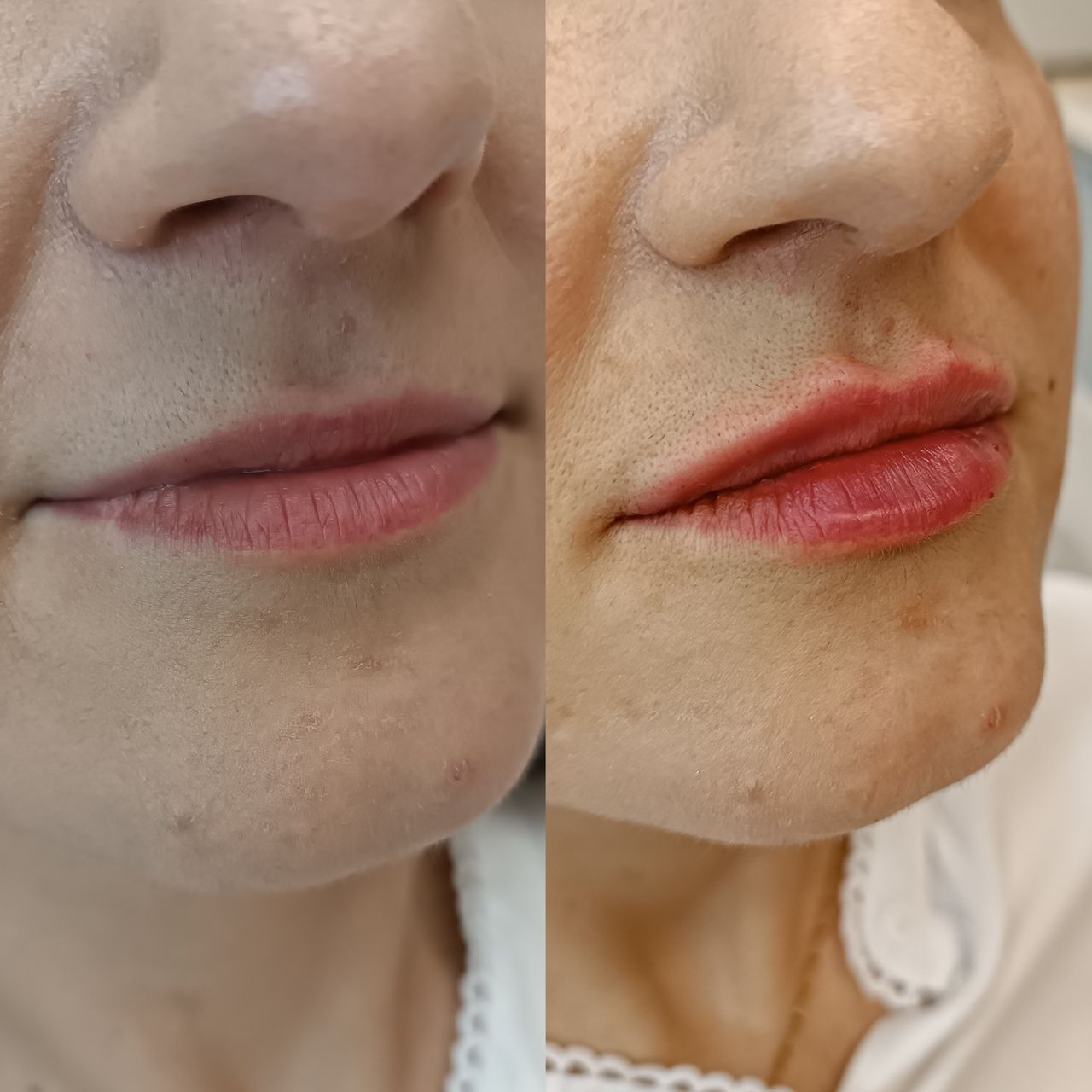 Michalina Zagańczyk-Bączek-11