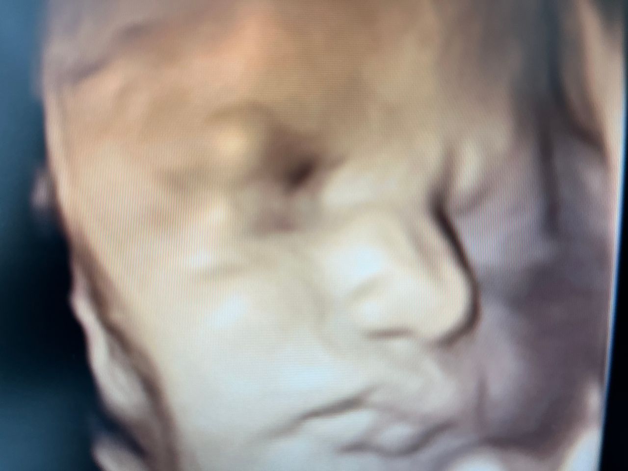 Jose Santiago-Cuadri Artacho-5