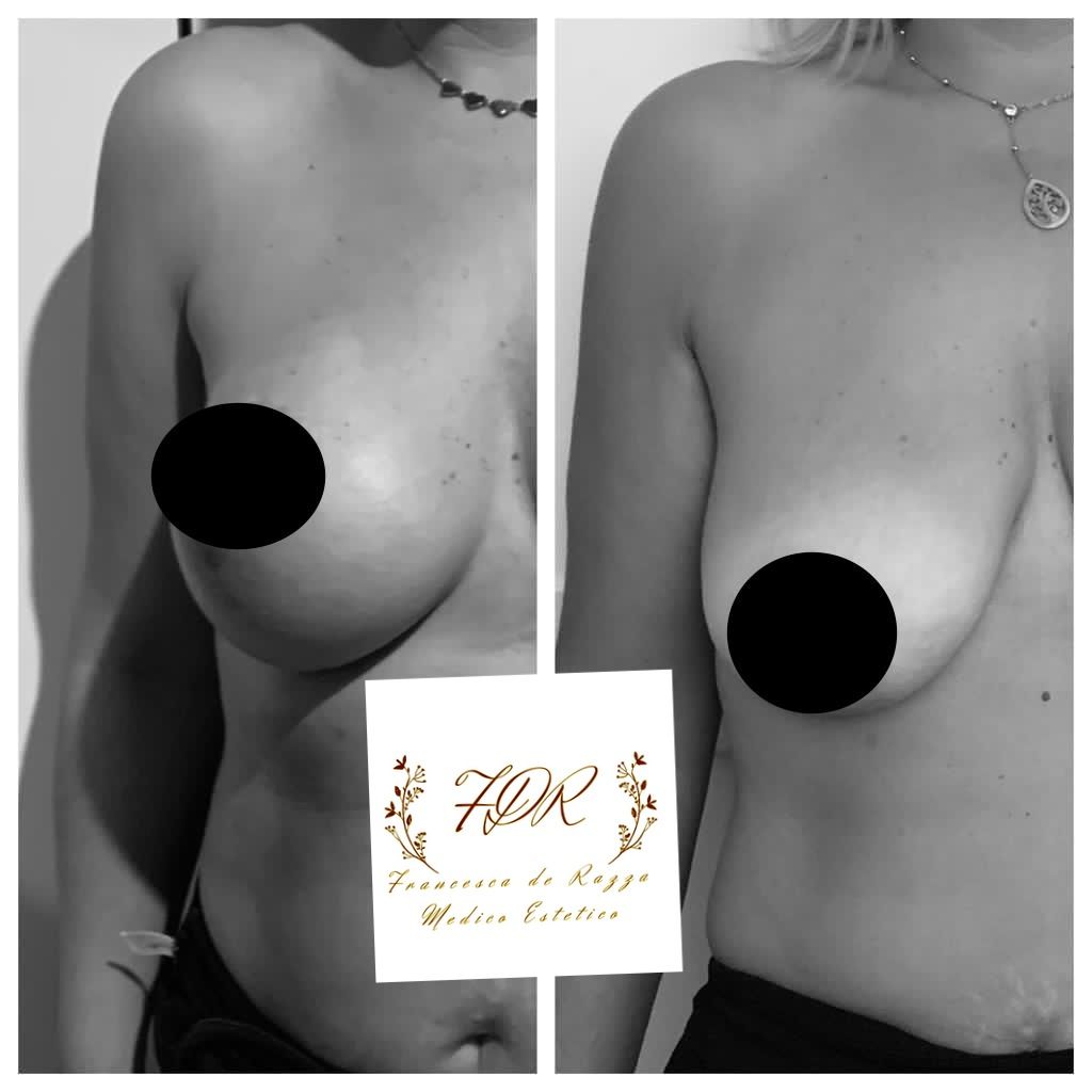 Francesca De Razza-34