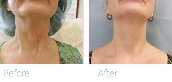 Nunzio Castiglione-10