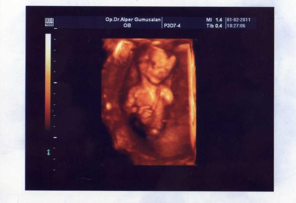 Alper Gümüşalan-3