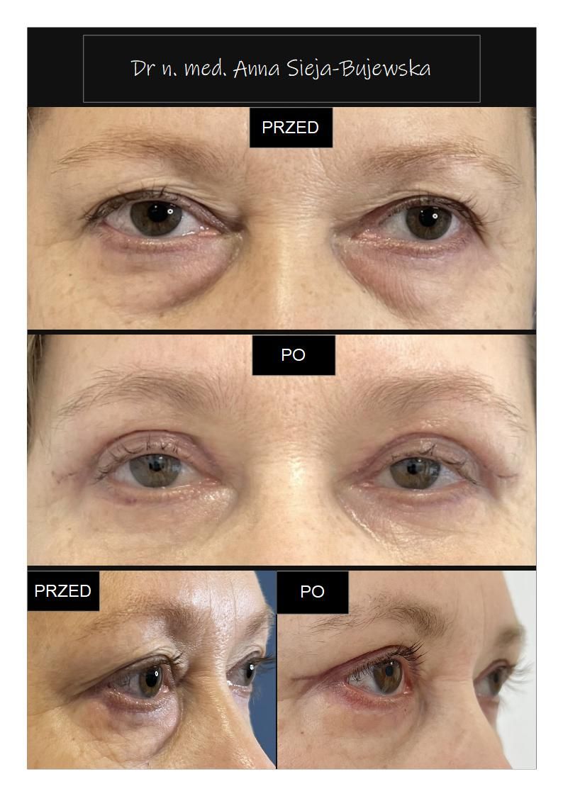 Anna Sieja-Bujewska-10