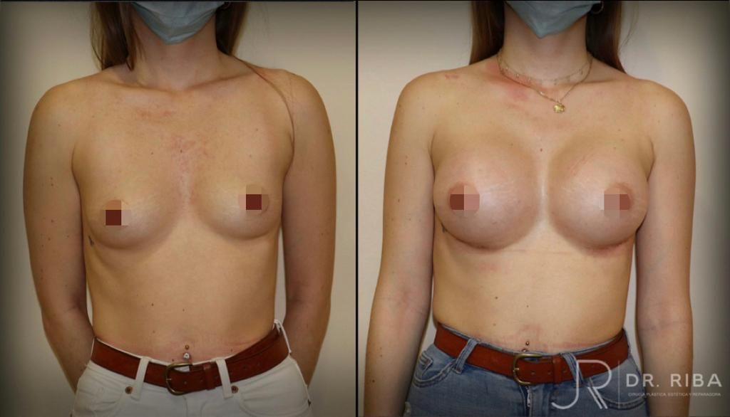 Jordi Riba Vilchez-56