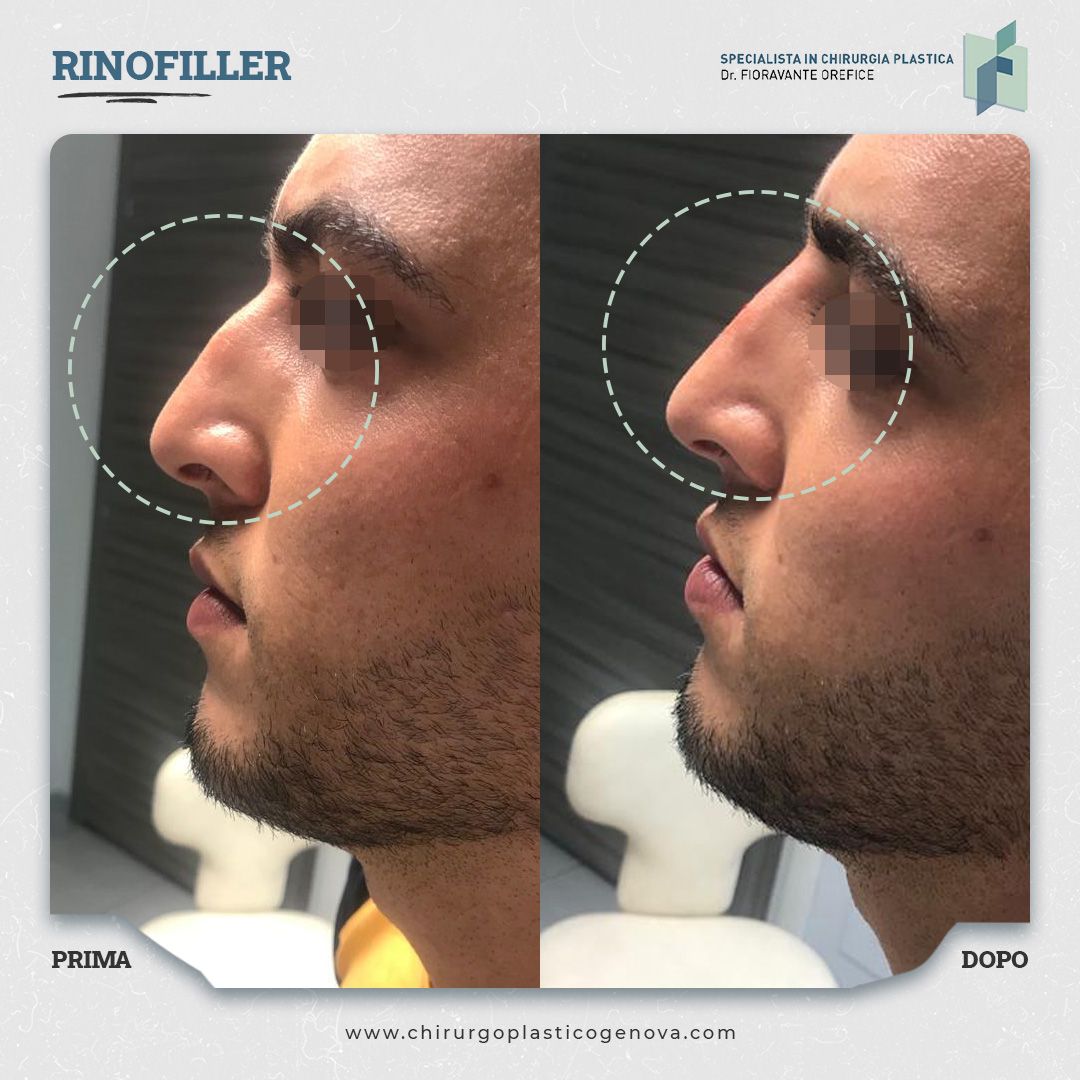 Fioravante Orefice-21