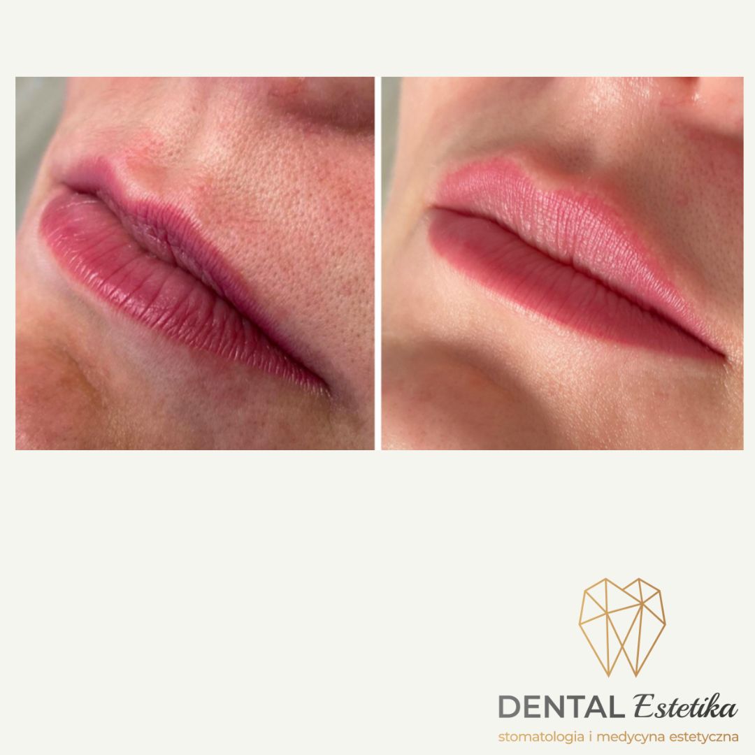 Angelika Świątkowska-27