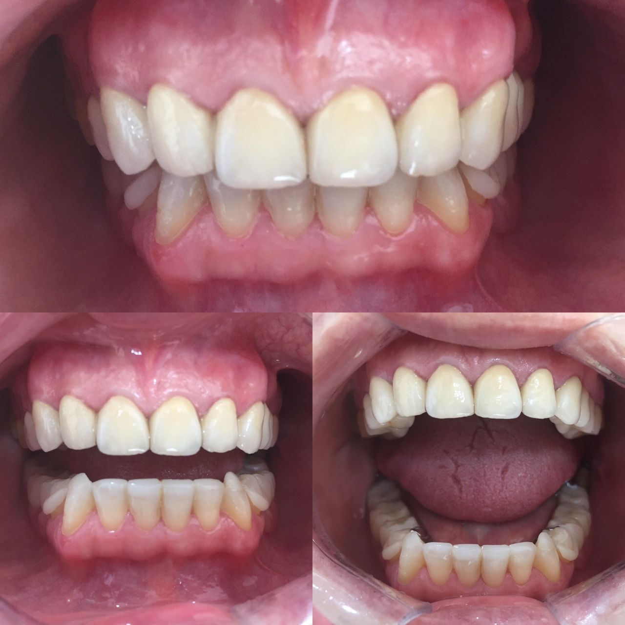 Antonia Aviles Lopez-58