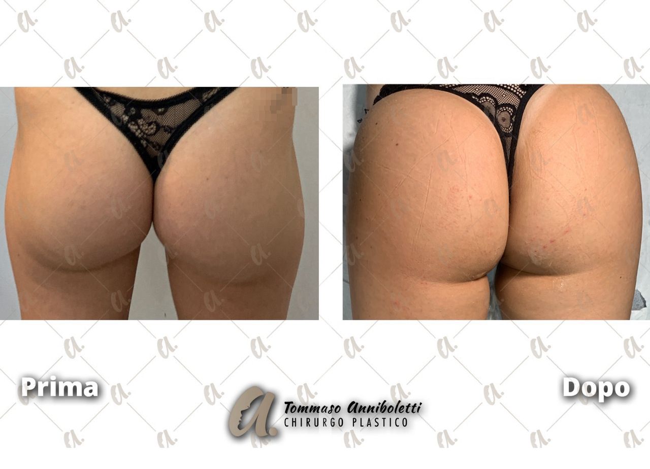 Tommaso Anniboletti-2